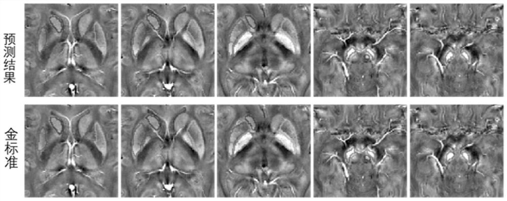 QSM deep brain nucleus automatic segmentation method based on deep learning