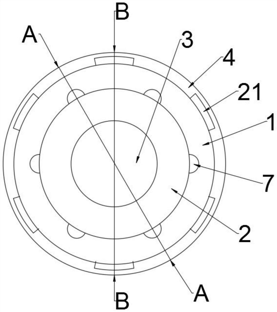 a hip prosthesis