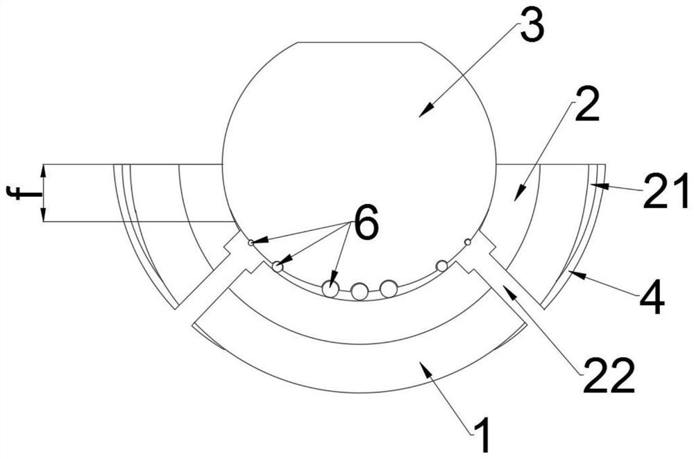 a hip prosthesis