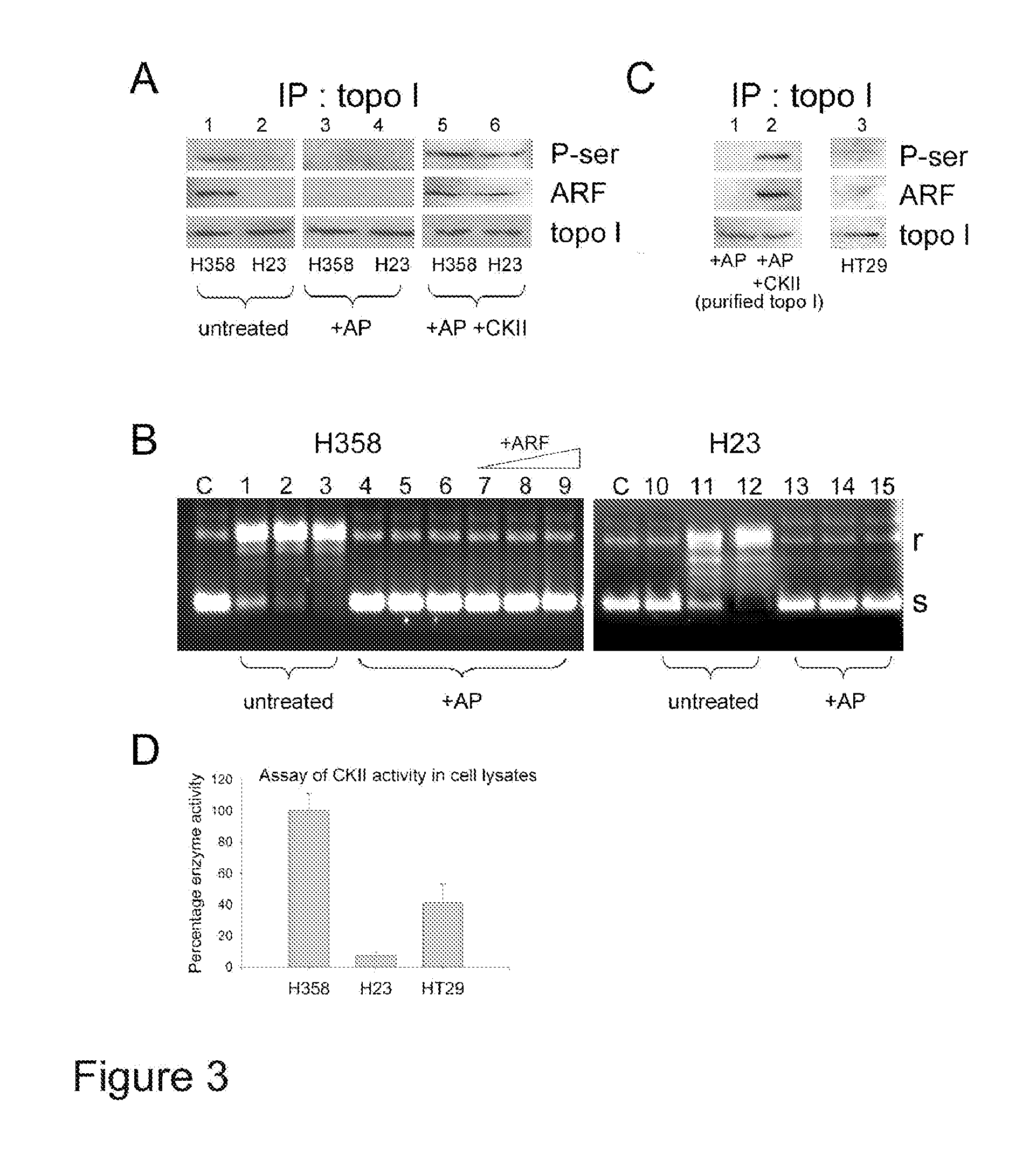 Methods and compositions for topoisomerase i modulated tumor suppression