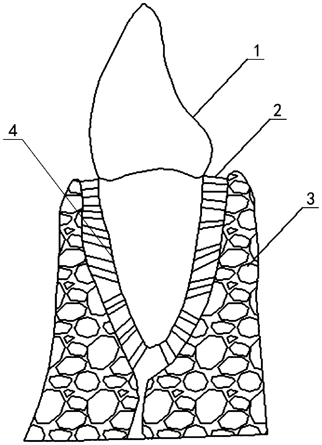 Periodontal ligament stress analysis method and device