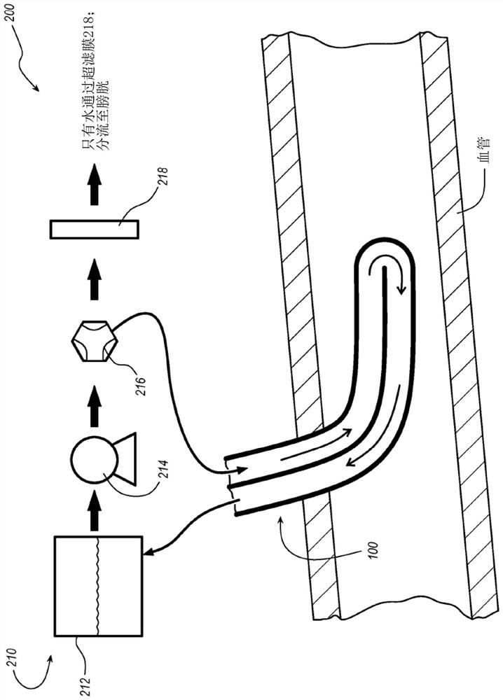 Catheters, catheter-based systems, and methods thereof for treating hypervolemia