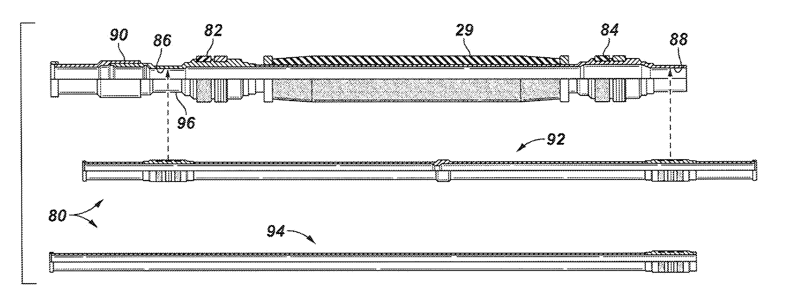 Zonal isolation system