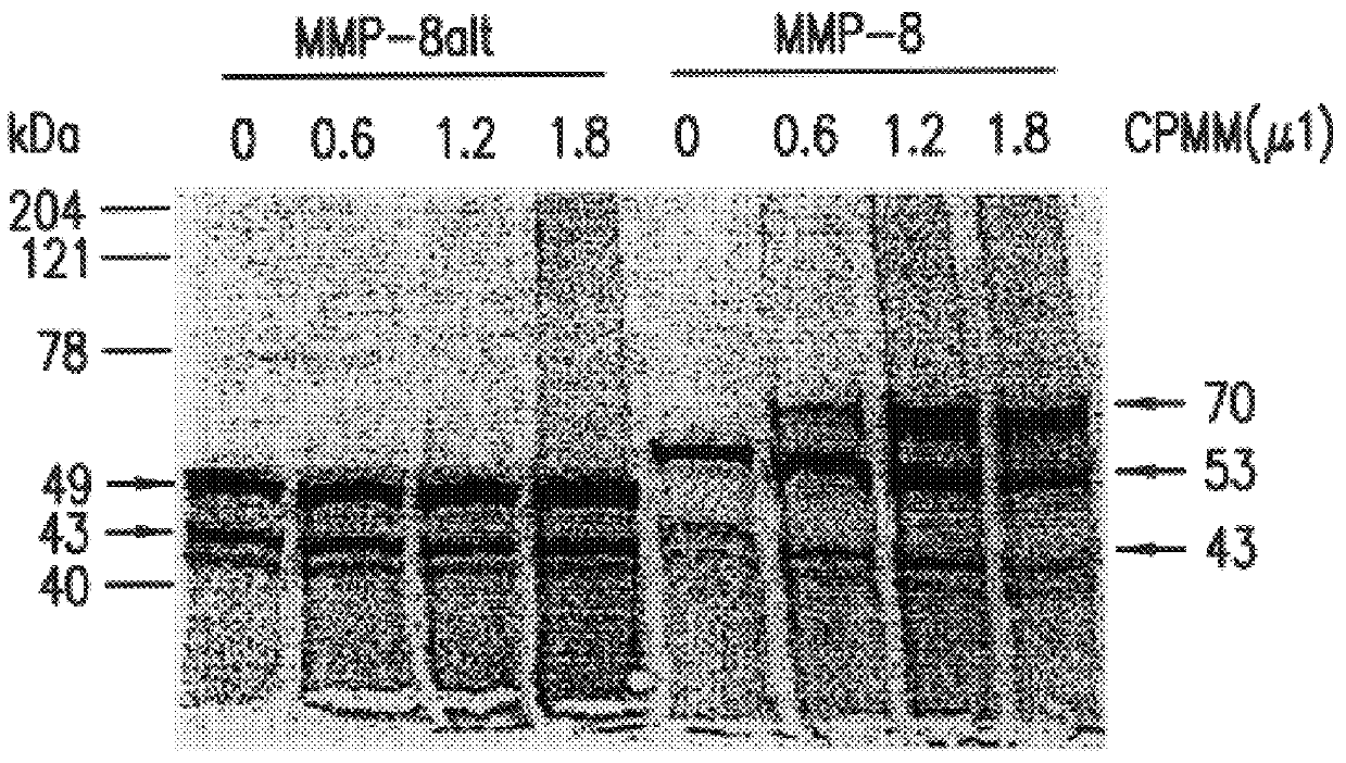 Human neutrophil collagenase splice variant
