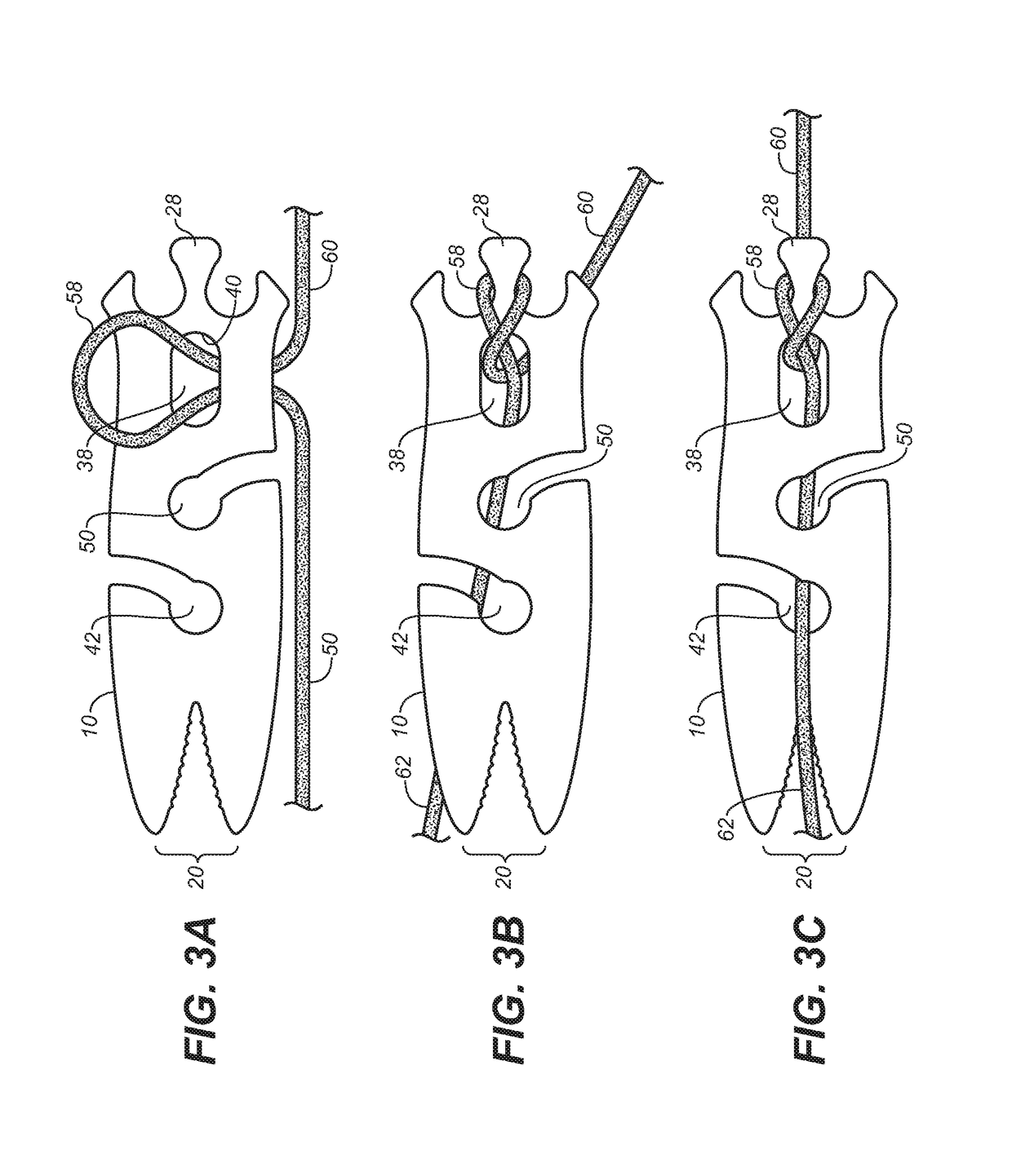 Rope tensioning and fastening device