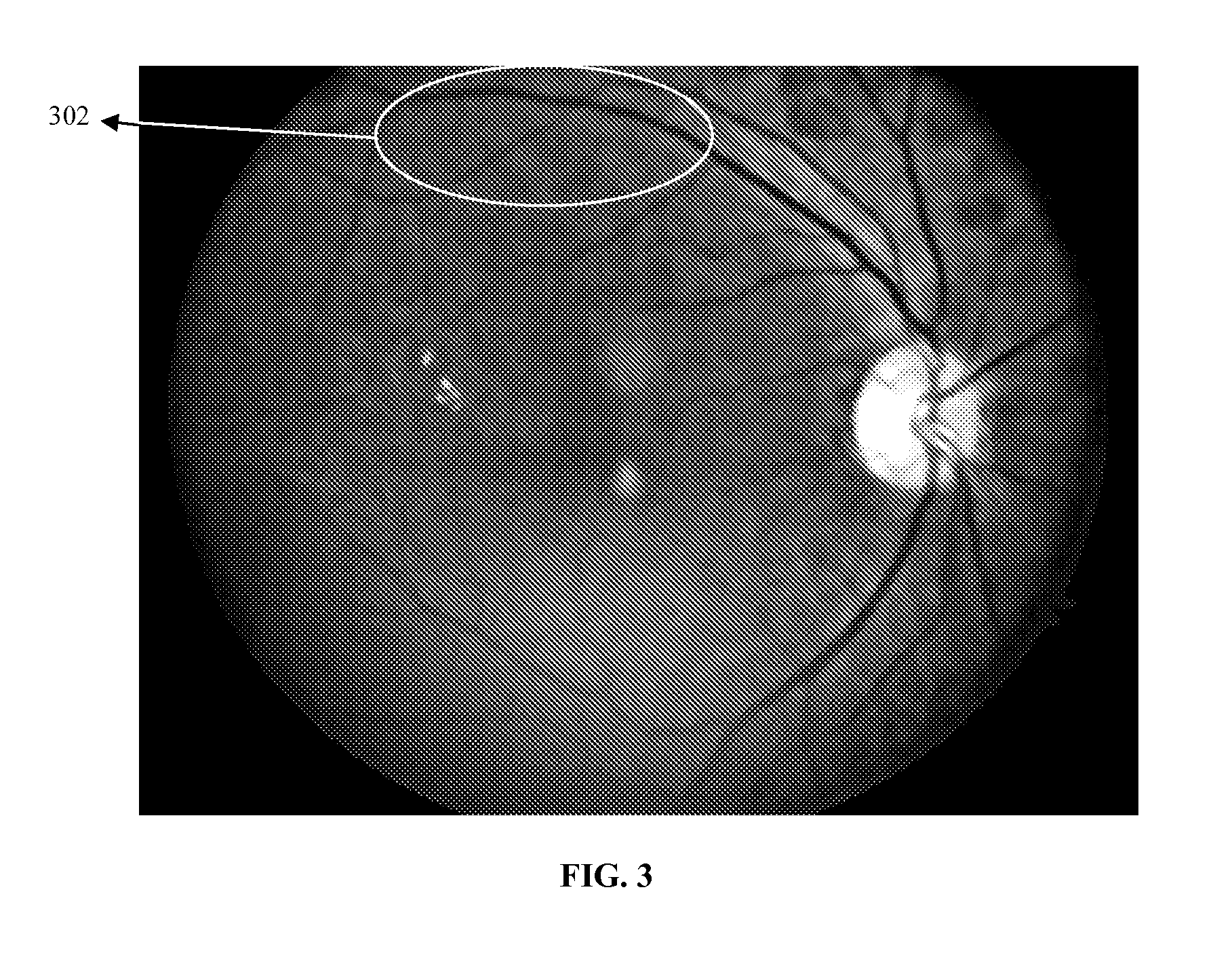 Method and system for enhancing image quality