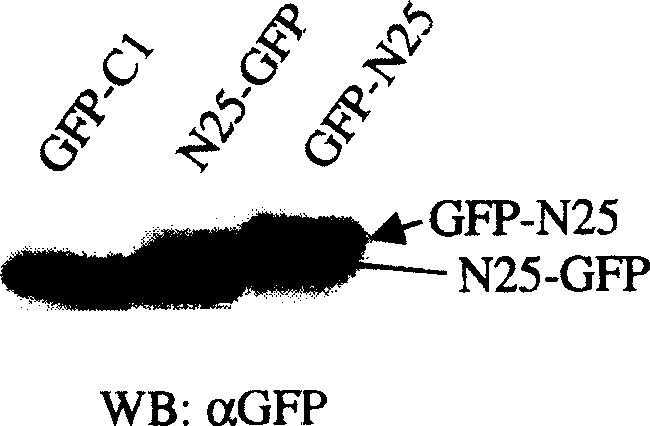 Obtaining of cell growth inhibiting polypeptide and its usage