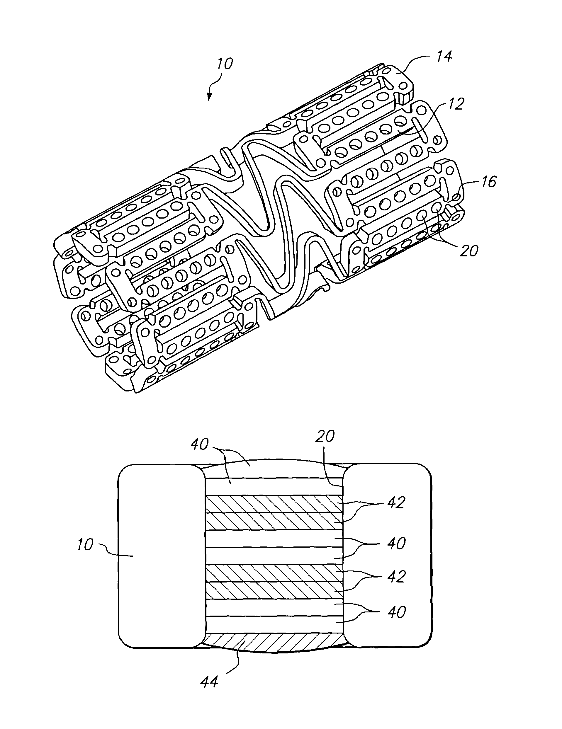 Implantable medical device with drug filled holes