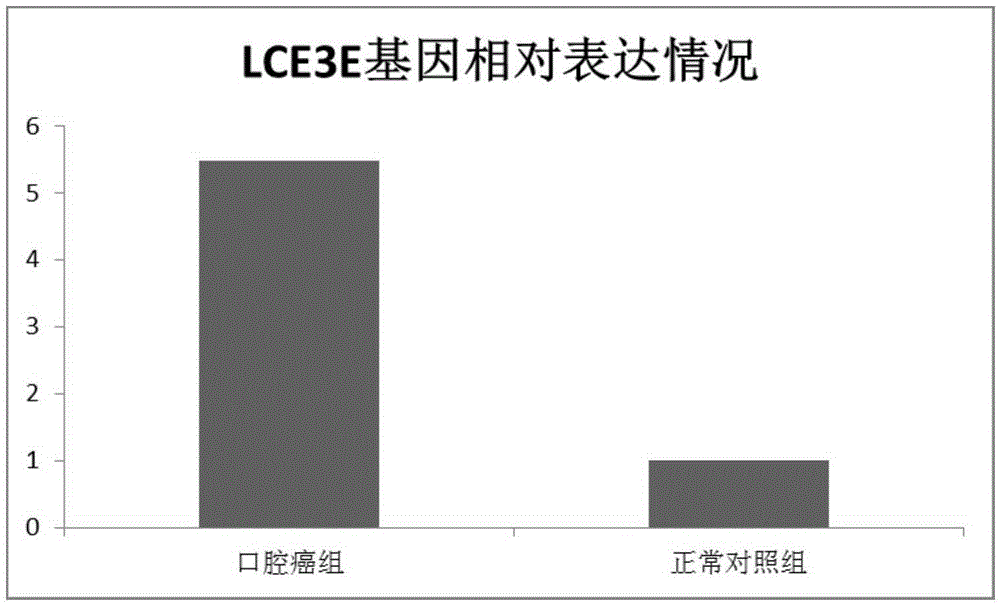 Application of LCE3E to diagnosis and treatment of oral cancer
