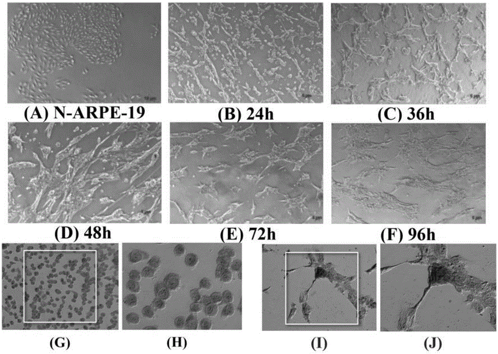 Retinal pigment epithelium epithelial-mesenchymal transition model and application thereof