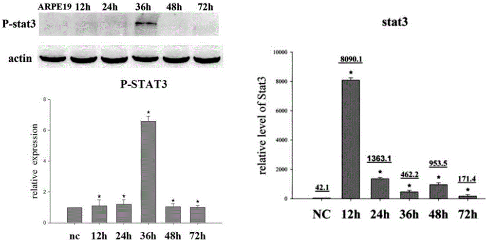 Retinal pigment epithelium epithelial-mesenchymal transition model and application thereof