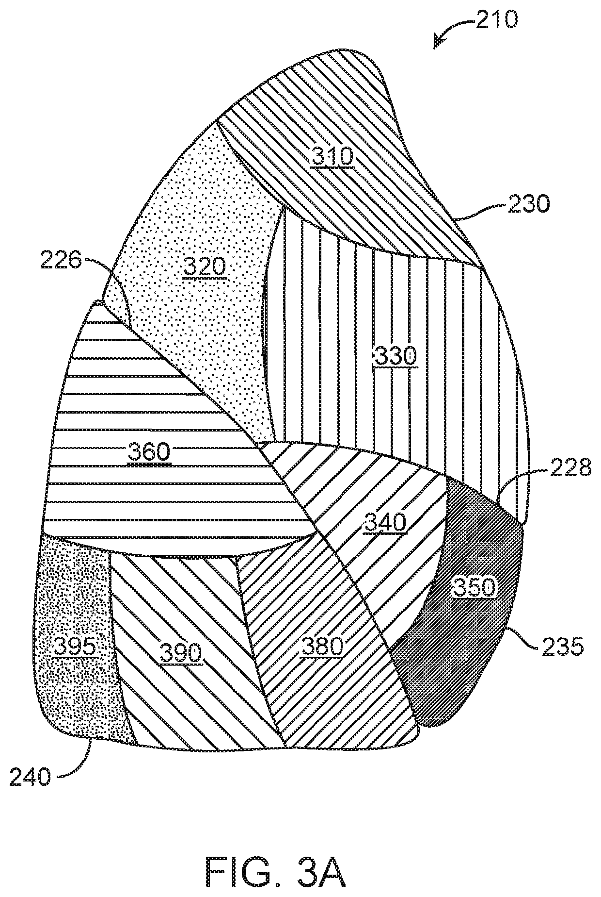 High resistance implanted bronchial isolation devices and methods