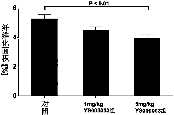 Piperidine medicine for preventing and treating fatty liver diseases and related diseases