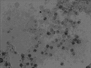 LET-7micro ribose nucleic acid (MIRNA) level in-situ hybridization detection kit for pathologic evolution early stage of various cancer, and detection method and application