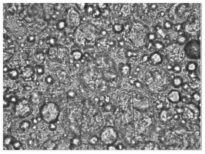 Itching-relieving emulsifiable paste for treating anal itching and preparation method of itching-relieving emulsifiable paste