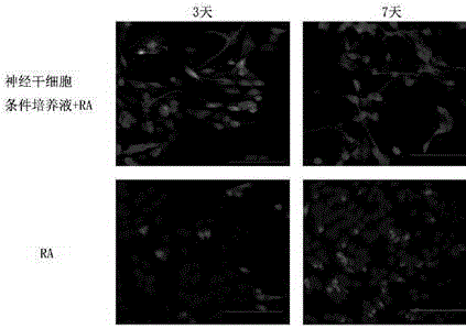 Method for inducing neuroblastoma cells to be differentiated to nerve cells