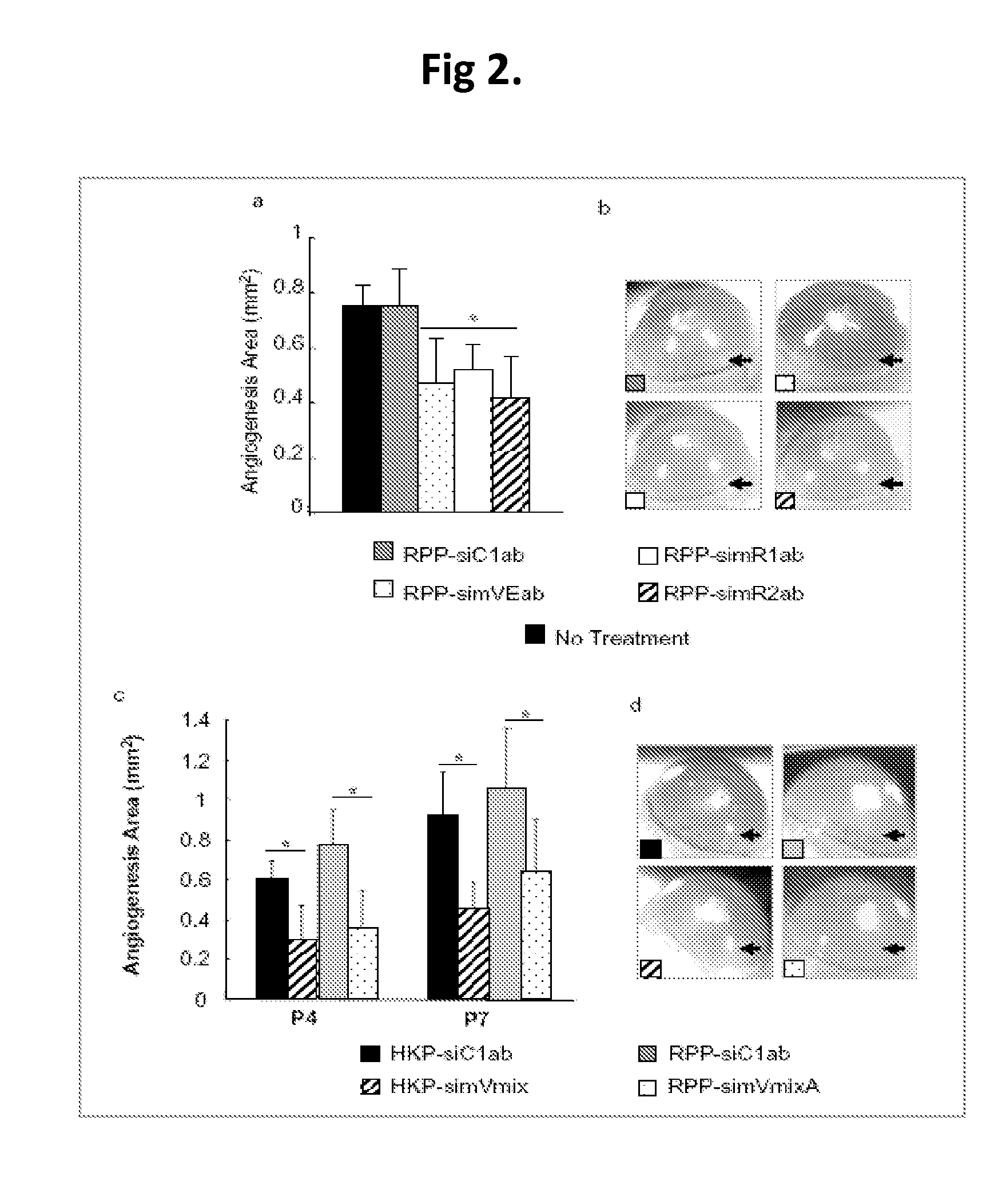Compositions and Methods Using siRNA Molecules and siRNA Cocktails for the Treatment of Breast Cancer