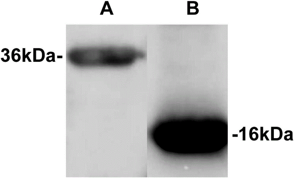 Hybridoma cell strain, secreted monoclonal antibody and application thereof