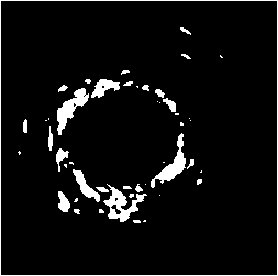 An automatic detection method of vascular adventitia based on intravascular ultrasound images