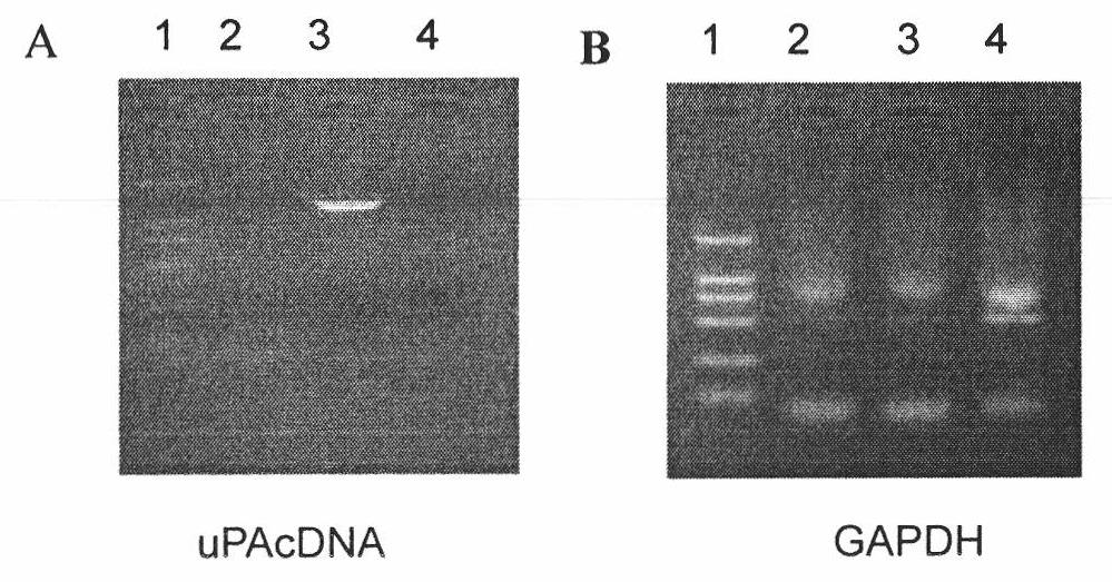 Vector of uPA expression regulated by Tet-on system and application thereof