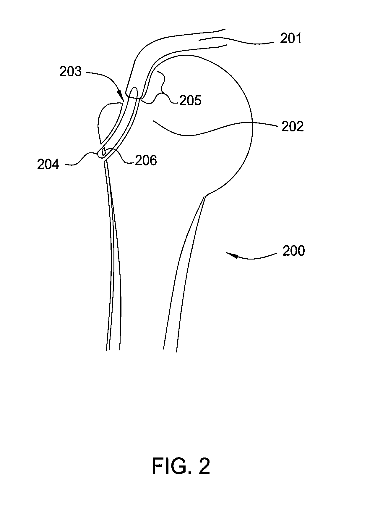 Suture-Retaining Device And Anchor
