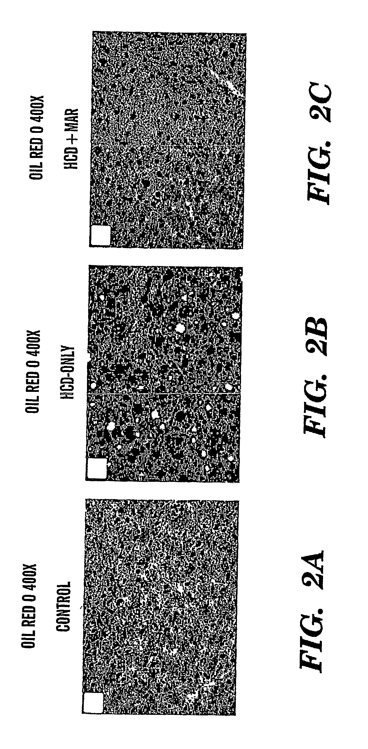 Method of treating fatty liver disease
