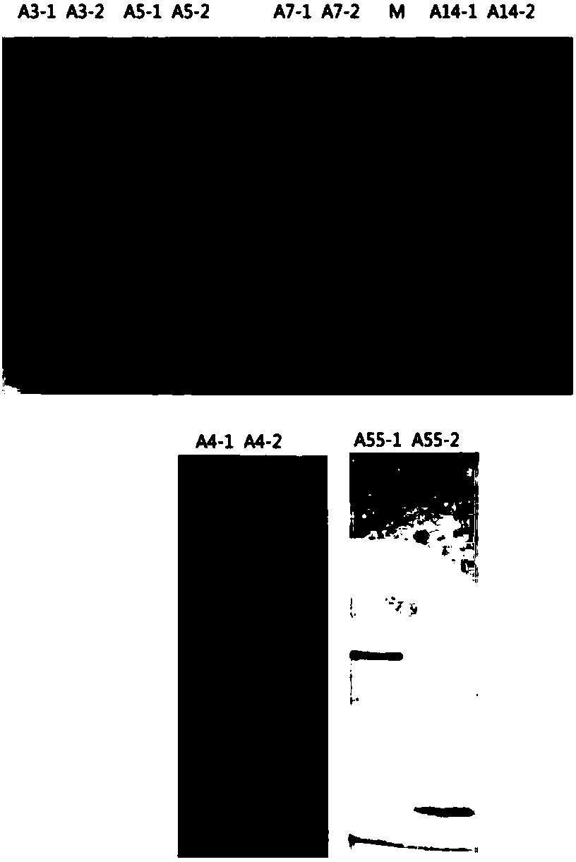 Recombinant expression adenovirus fiber peptide, adenovirus subunit vaccine and preparation method of adenovirus cilia protein peptide