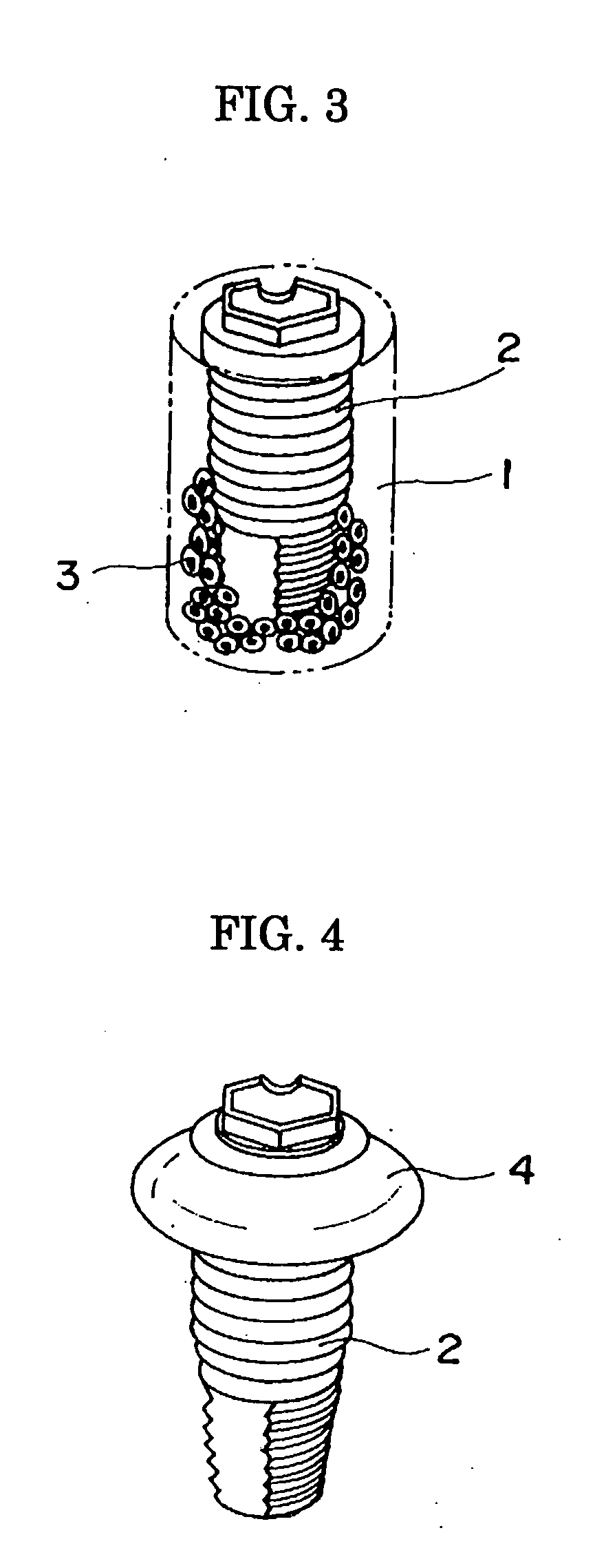 Method for fixing an implant, fixing member for the implant and implant composite