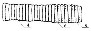 Specific in-vivo lumen implant