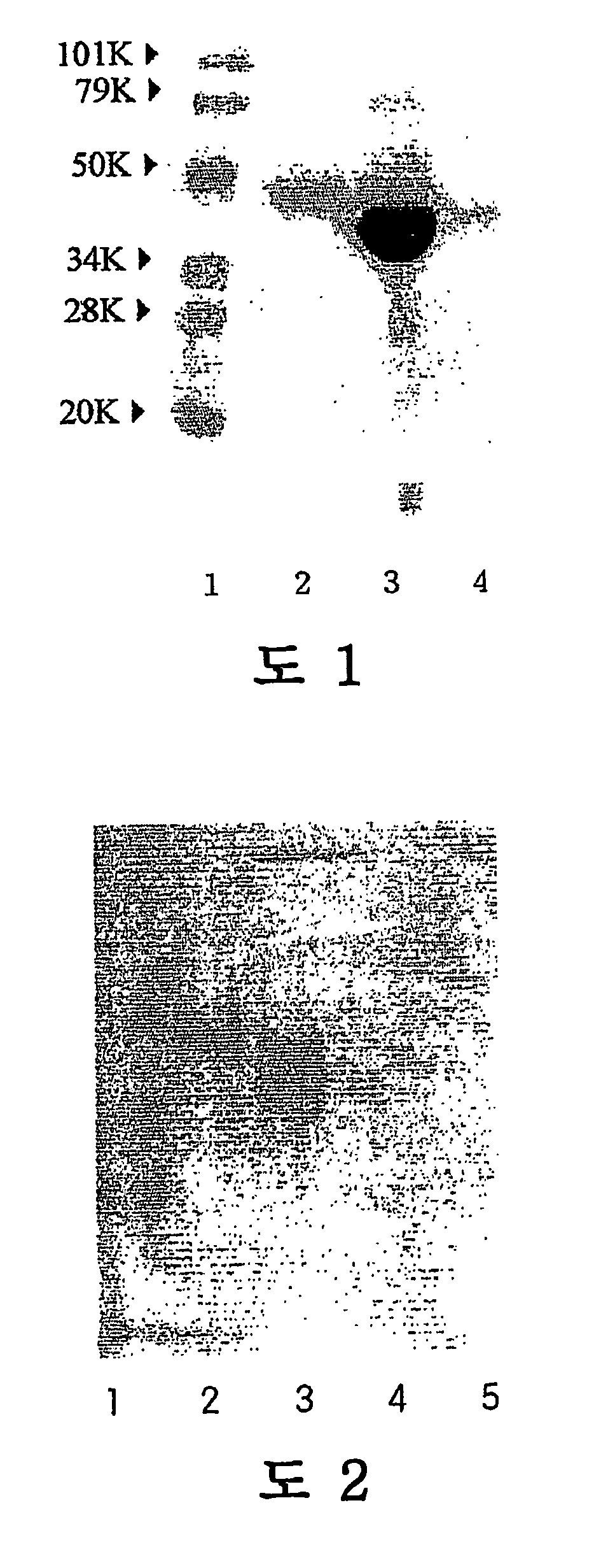 Monoclonal antibody against asialo alpha 1-acid glycoprotein, immunochromatographic strip comprising the monoclonal antibody, and method for diagnosing liver diseases using the immunochromatographic strip