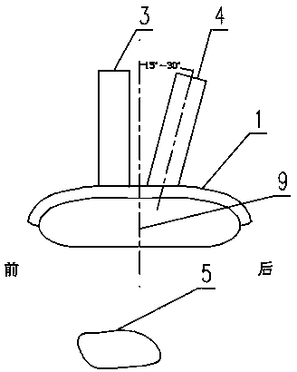 Surgical guide in coracoclavicular ligament reconstruction and manufacturing method thereof