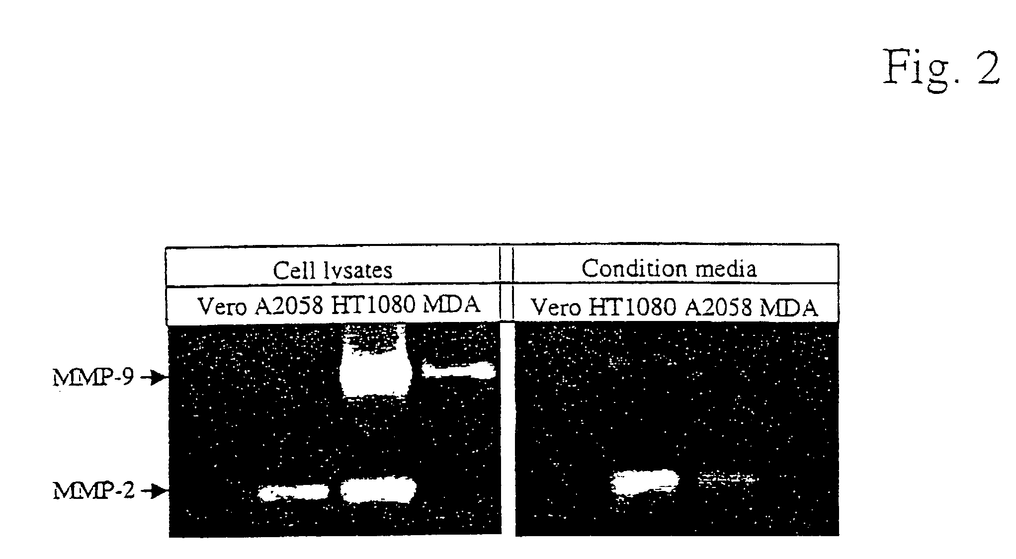 Mutated anthrax toxin protective antigen proteins that specifically target cells containing high amounts of cell-surface metalloproteinases or plasminogen activator receptors