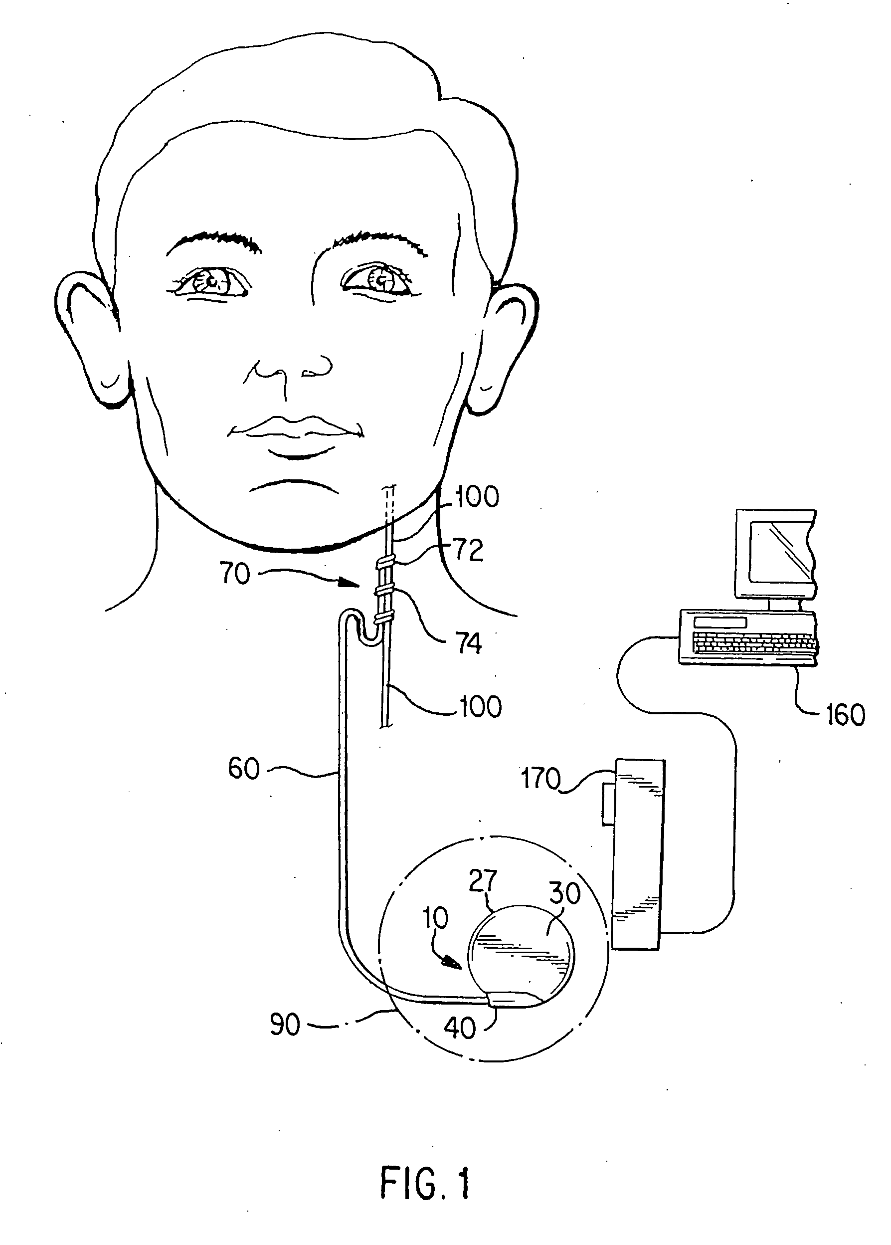 Cranial nerve stimulation to treat a vocal cord disorder