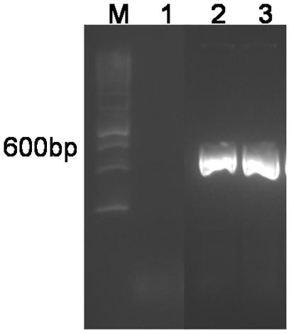 Chlorotoxin polypeptide-ferritin heavy chain fusion protein, self-assembled protein nanocage and its preparation method and application