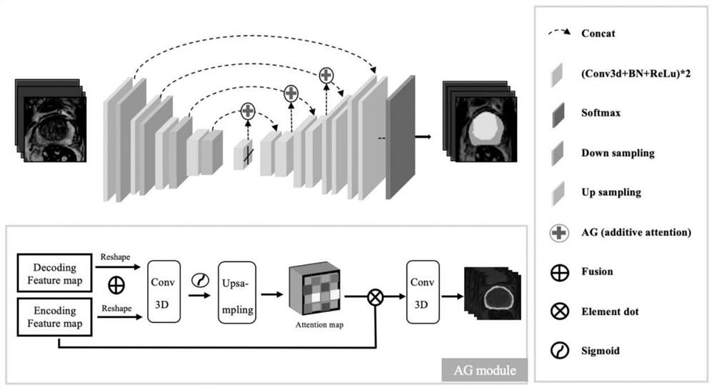Medical image segmentation method based on 3D dynamic edge insensitivity loss function