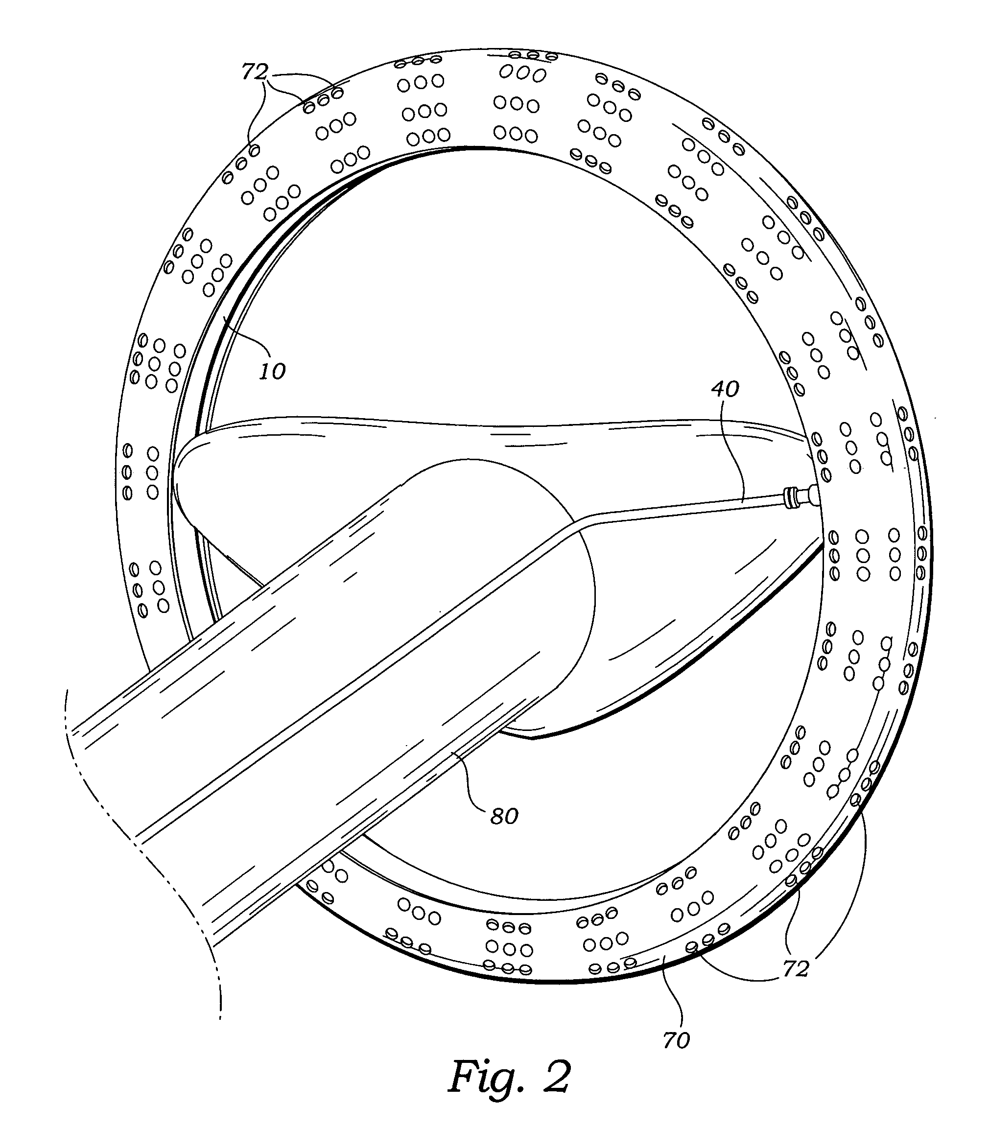 Steering wheel vapor collection and sensing system using suction