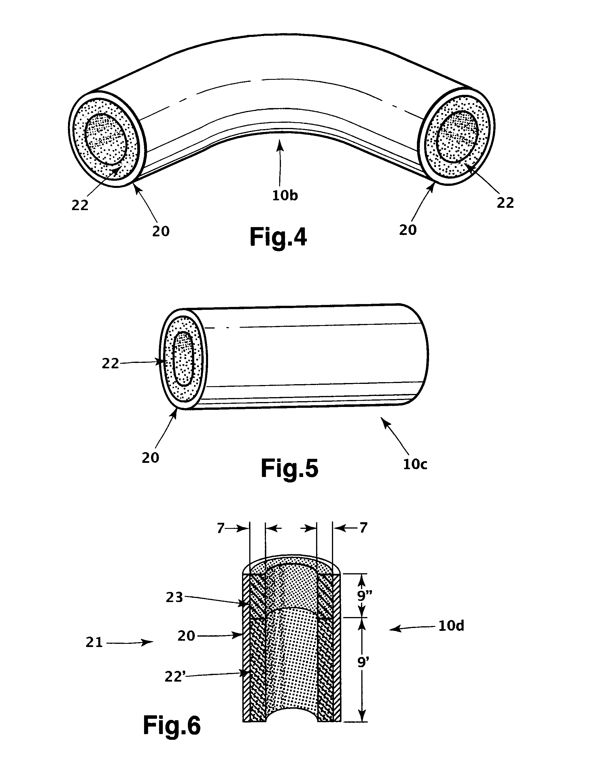 Metal tube with porous metal liner