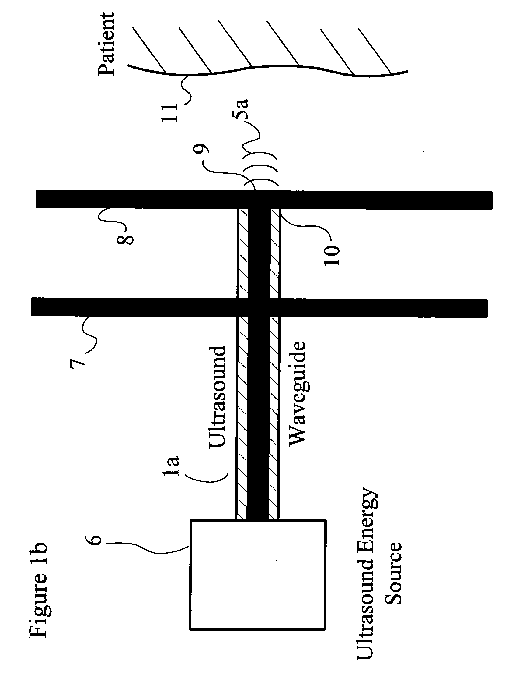 Ultrasonic apparatus and method for treating obesity or fat-deposits or for delivering cosmetic or other bodily therapy