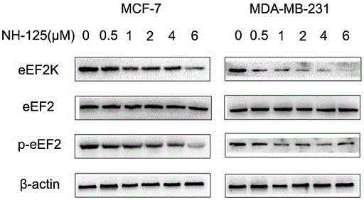 Tumor radiosensitizer containing eEF2K inhibitor