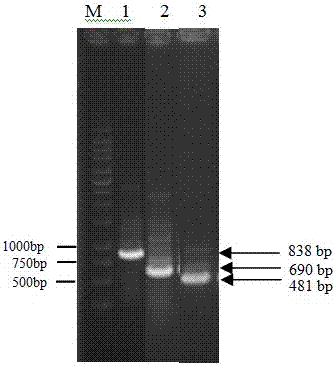 A kind of pullulanase enzyme-producing strain and the method for improving its enzyme-producing ability