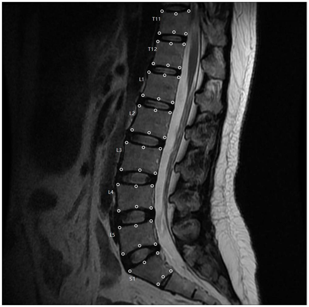 Spine MRI image key point detection method based on deep learning