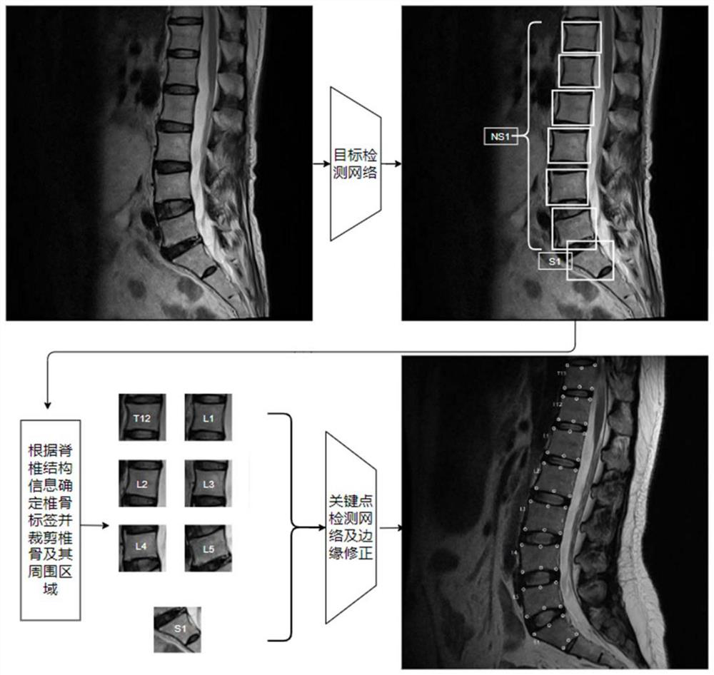 Spine MRI image key point detection method based on deep learning
