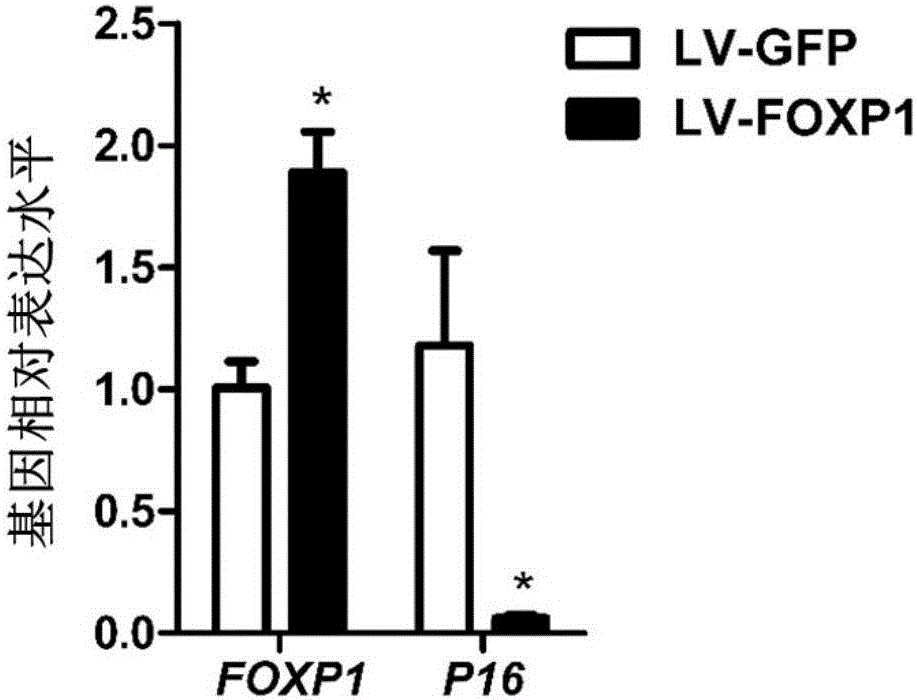 Method for delaying senescence due to in vitro culture of human bone marrow MSC (Mesenchymal Stem Cells)