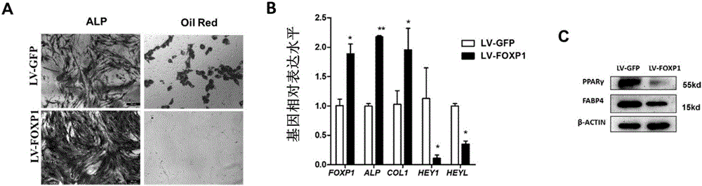 Method for delaying senescence due to in vitro culture of human bone marrow MSC (Mesenchymal Stem Cells)