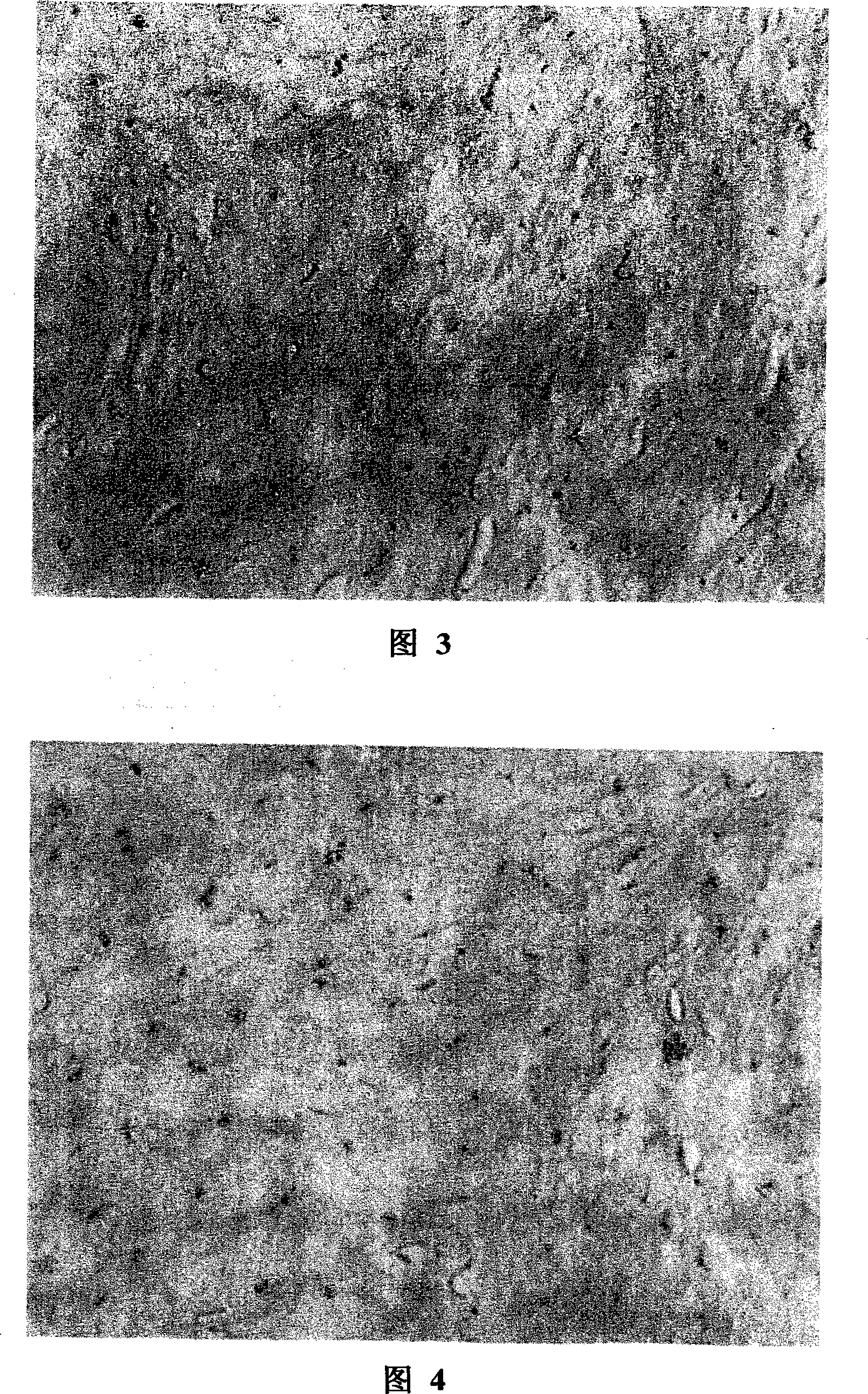 Preparation method for pig blood vessel acellular bracket by chemical and physical combination