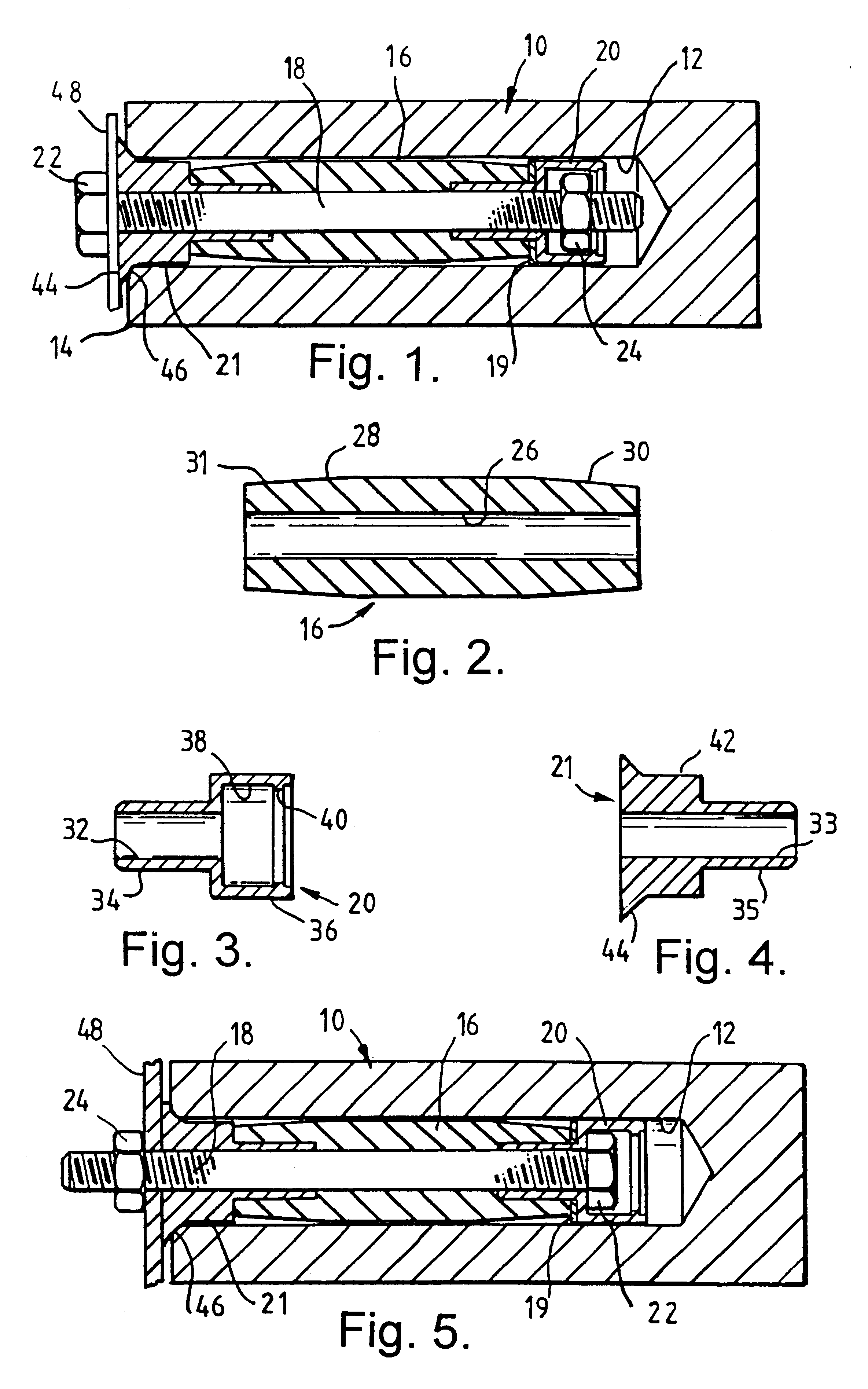 Anchoring device