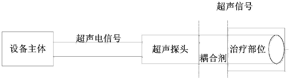 Ultrasonic therapeutic equipment capable of monitoring contact status of ultrasonic probe