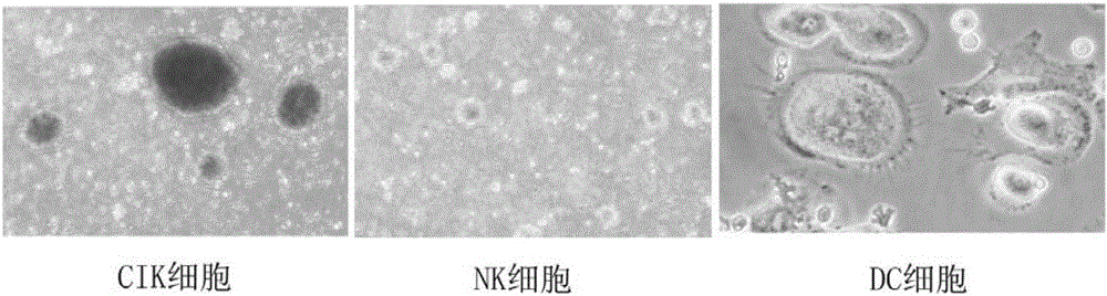 Kit for rapidly inducing large number of DC-CIK and NK cells with lymphocyte culture medium and use method of kit