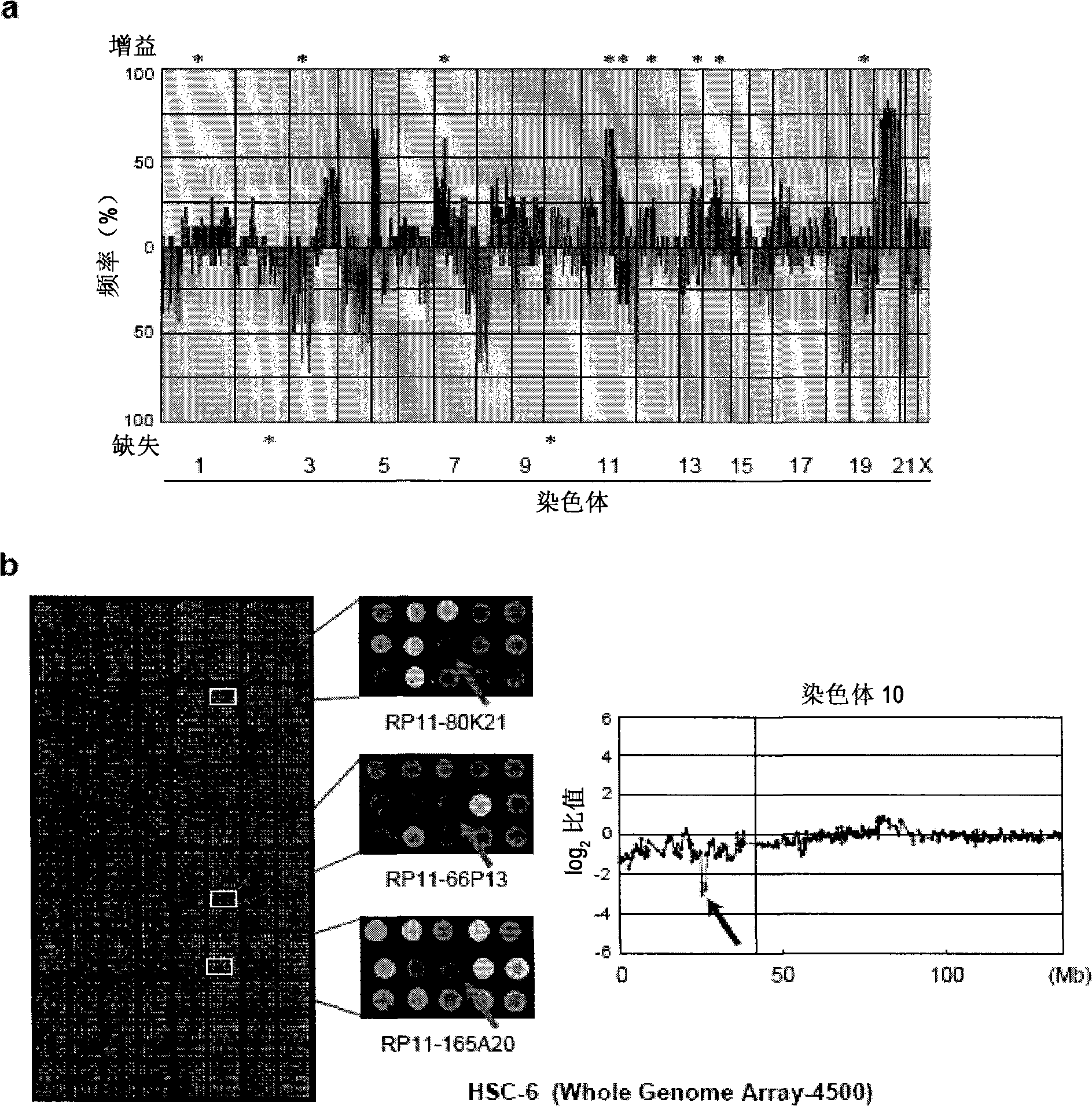 Method for detecting oral squamous-cell carcinoma and method for suppressing the same