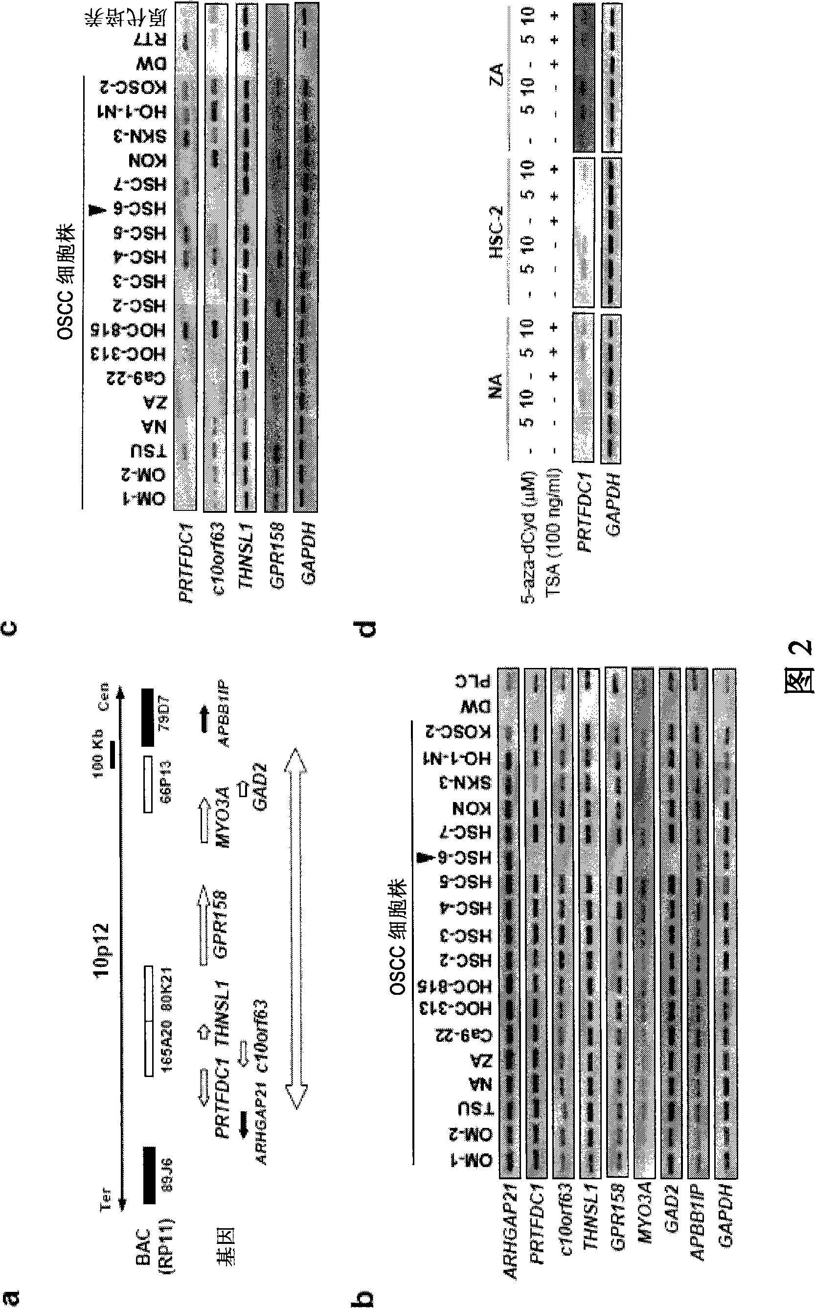 Method for detecting oral squamous-cell carcinoma and method for suppressing the same